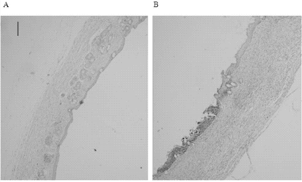 Synthetic peptide and application thereof