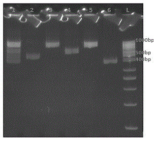 Quintuple PCR primers for detecting pathogenic bacteria in fresh agricultural products, probe and detection kit