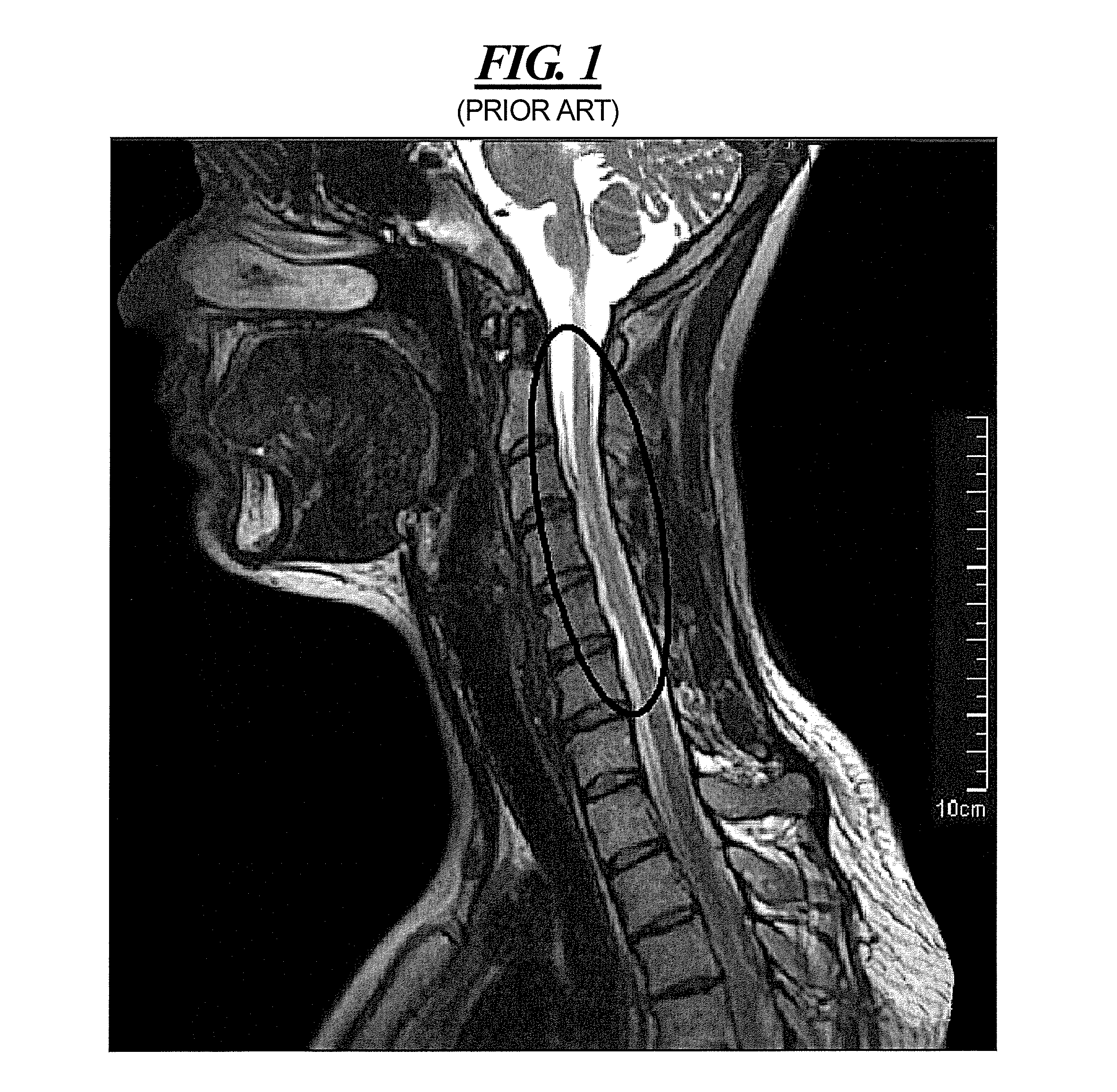 Magnetic resonance system and operating method for flow artifact reduction in slab selective space imaging