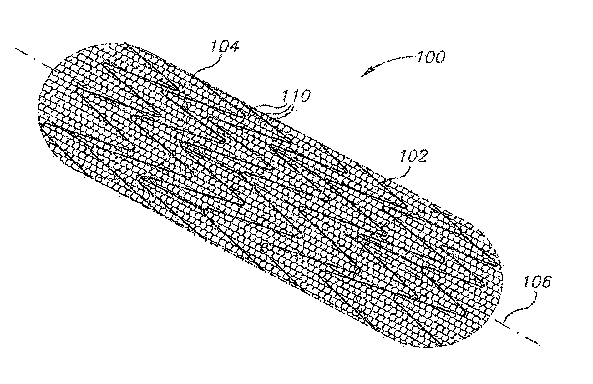 Stent with sheath and metal wire and methods