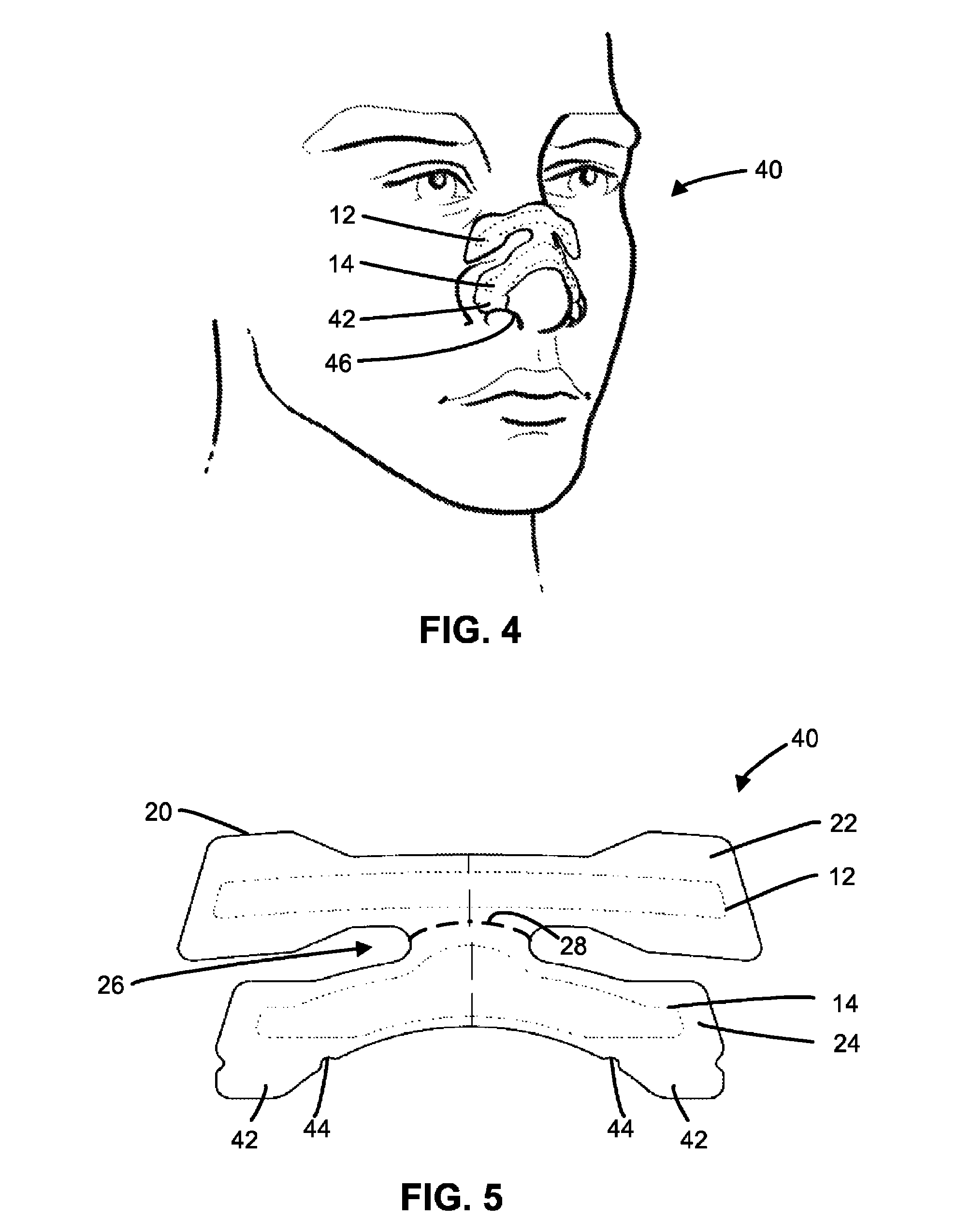 Nasal dilator