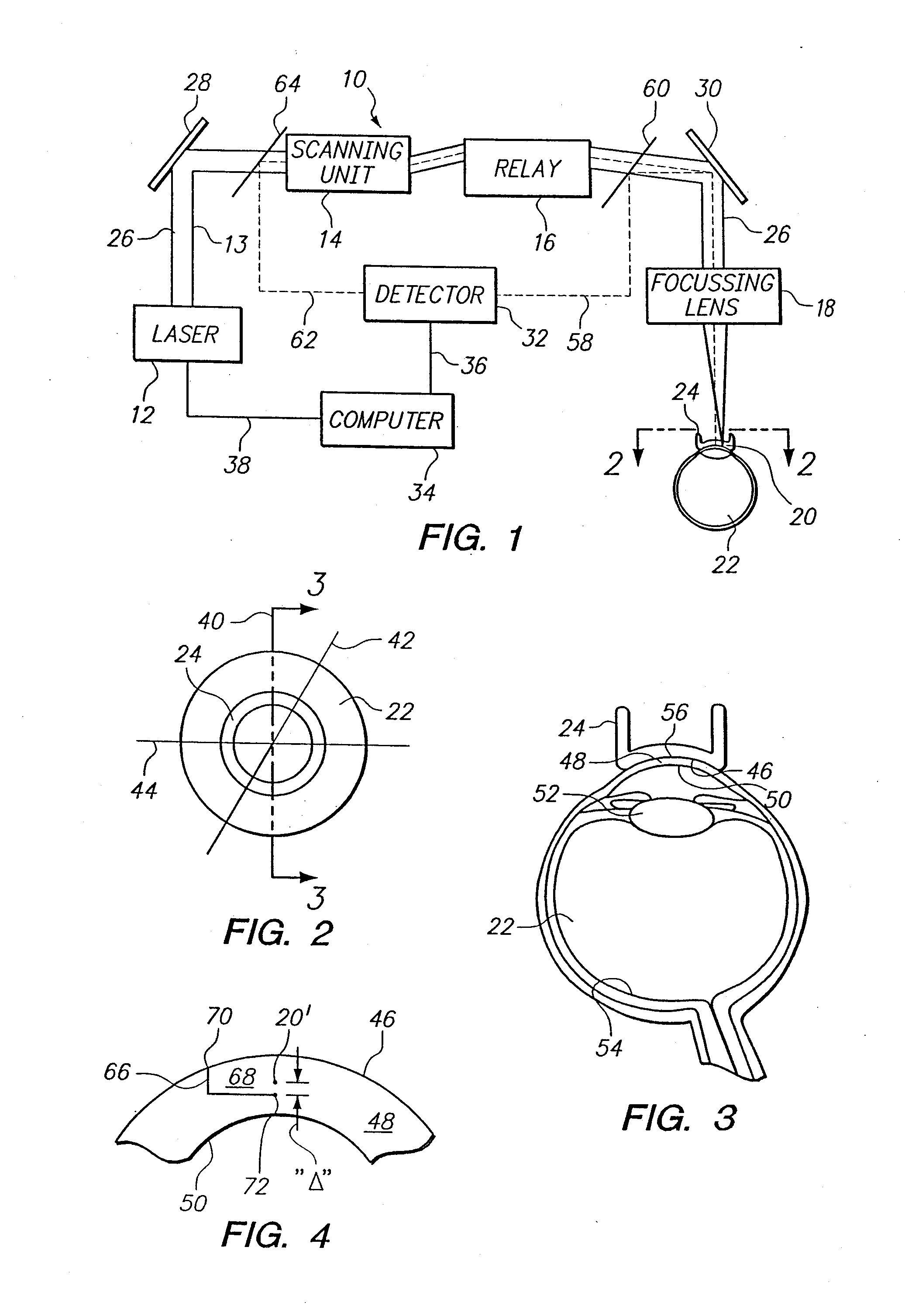 Apparatus and Method for Morphing a Three-Dimensional Target Surface into a Two-Dimensional Image for Use in Guiding a Laser Beam in Ocular Surgery