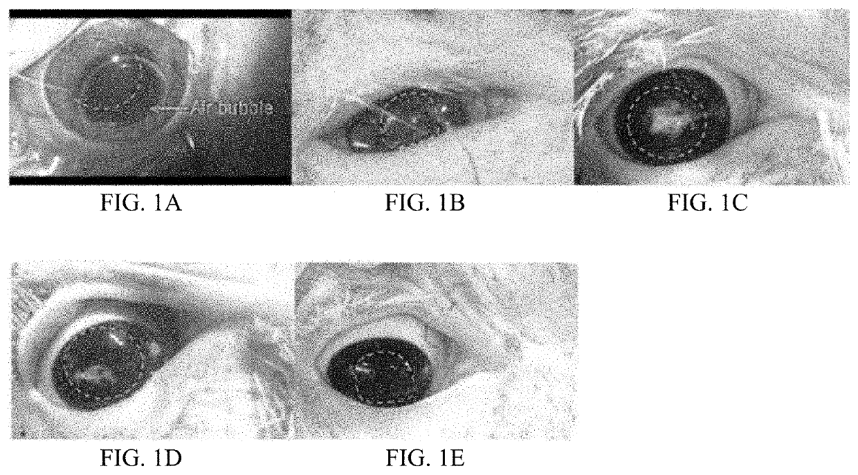 Composition of corneal implantation, and the use and preparation method thereof
