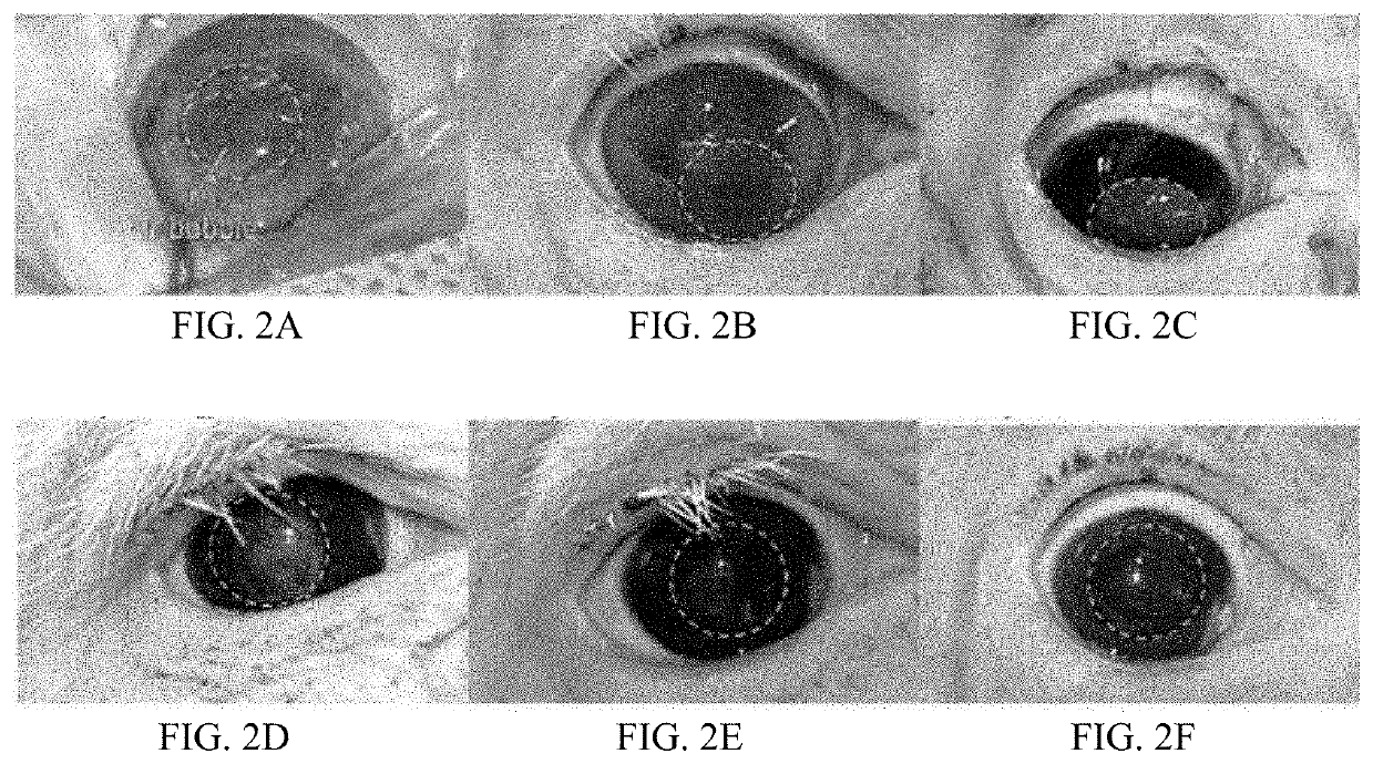 Composition of corneal implantation, and the use and preparation method thereof