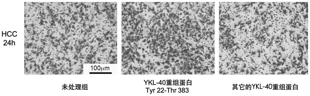 Anti-human YKL-40 neutralizing monoclonal antibody as well as preparation and application thereof