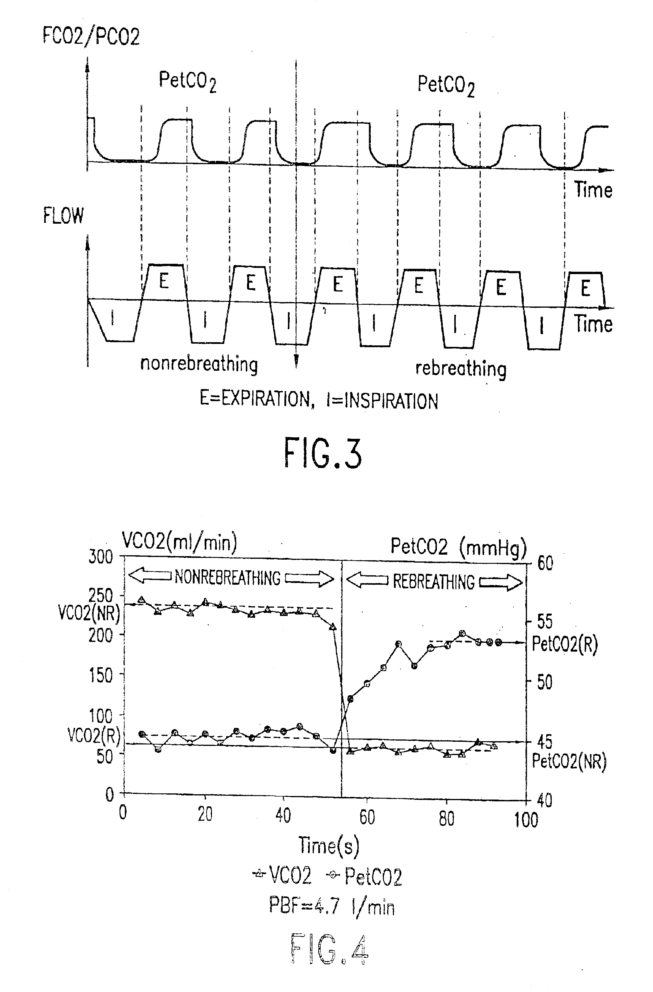 Arrangement for the determination of the effective pulmonary blood flow