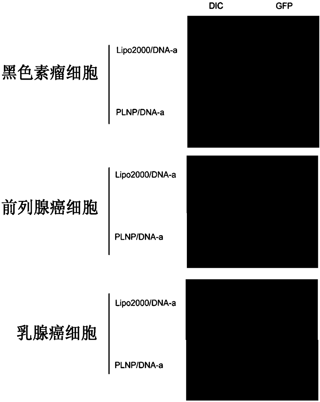 PLNPs as well as pharmaceutical composition and application thereof