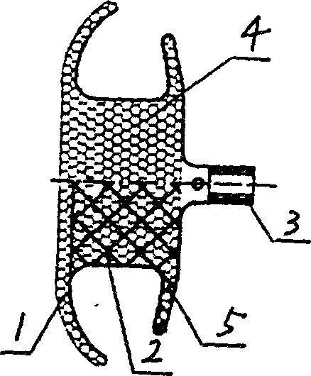 Ventricular septal defect blocking apparatus and its making method