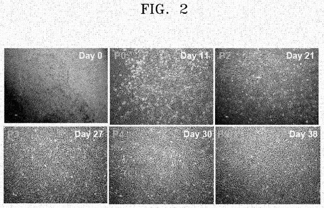 Medium for direct differentiation of pluripotent stem cell-derived mesenchymal stem cell, method for preparing mesenchymal stem cell by using same, and mesenchymal stem cell prepared thereby