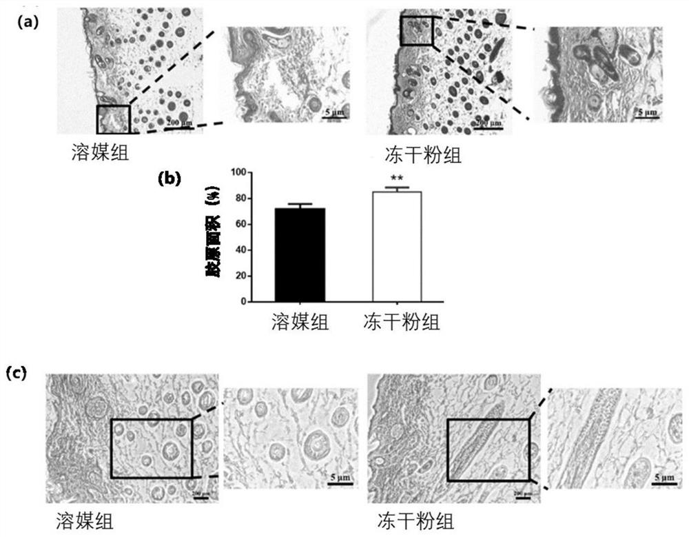 Conditioned medium, freeze-dried powder, preparation method and application