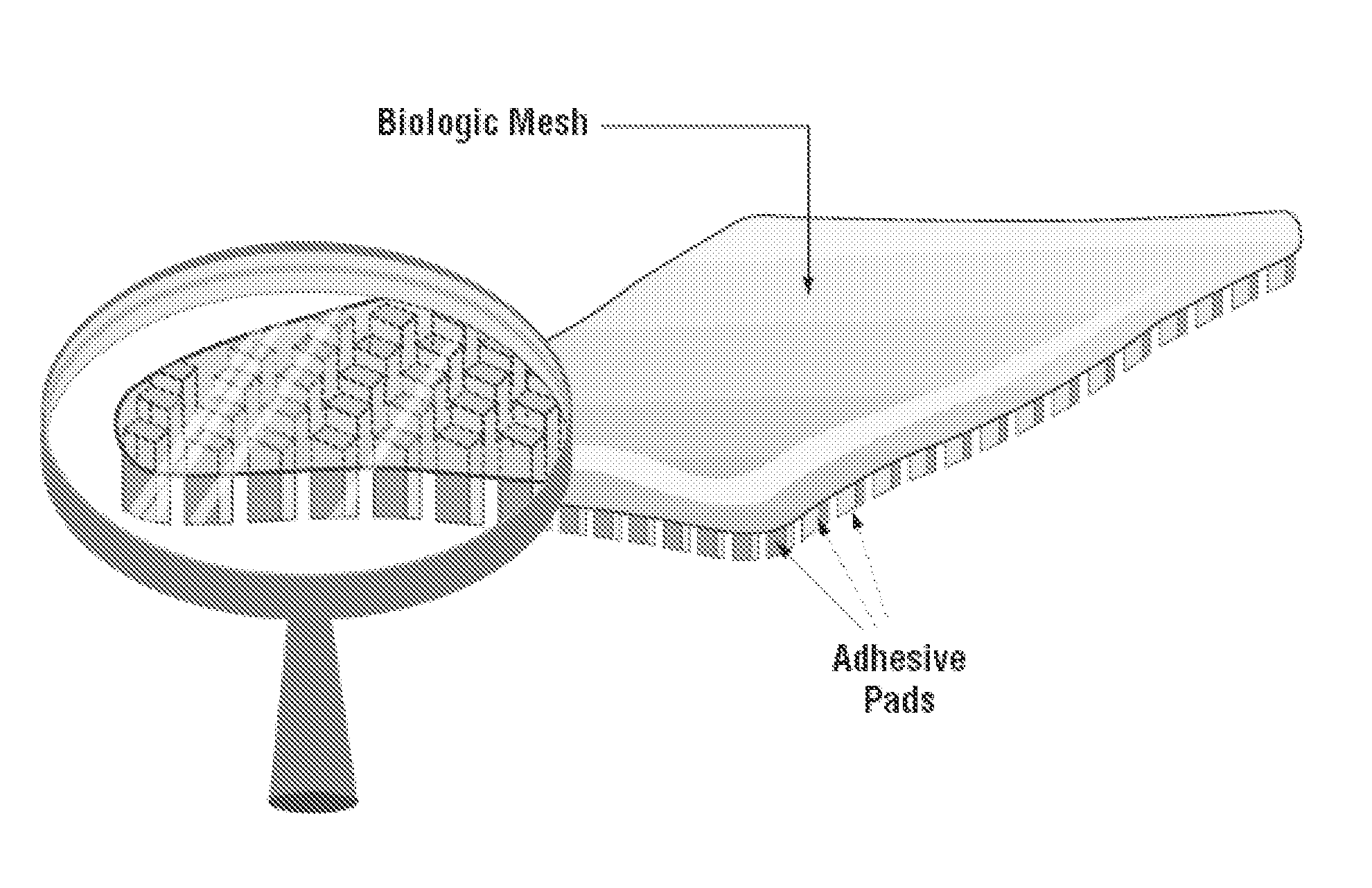 Multibranched bioadhesive compounds and synthetic methods therefor