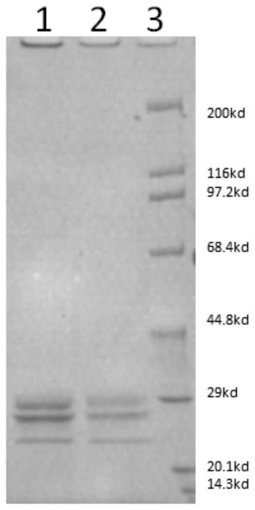 Method for screening monoclonal antibody pair not interfered by complement