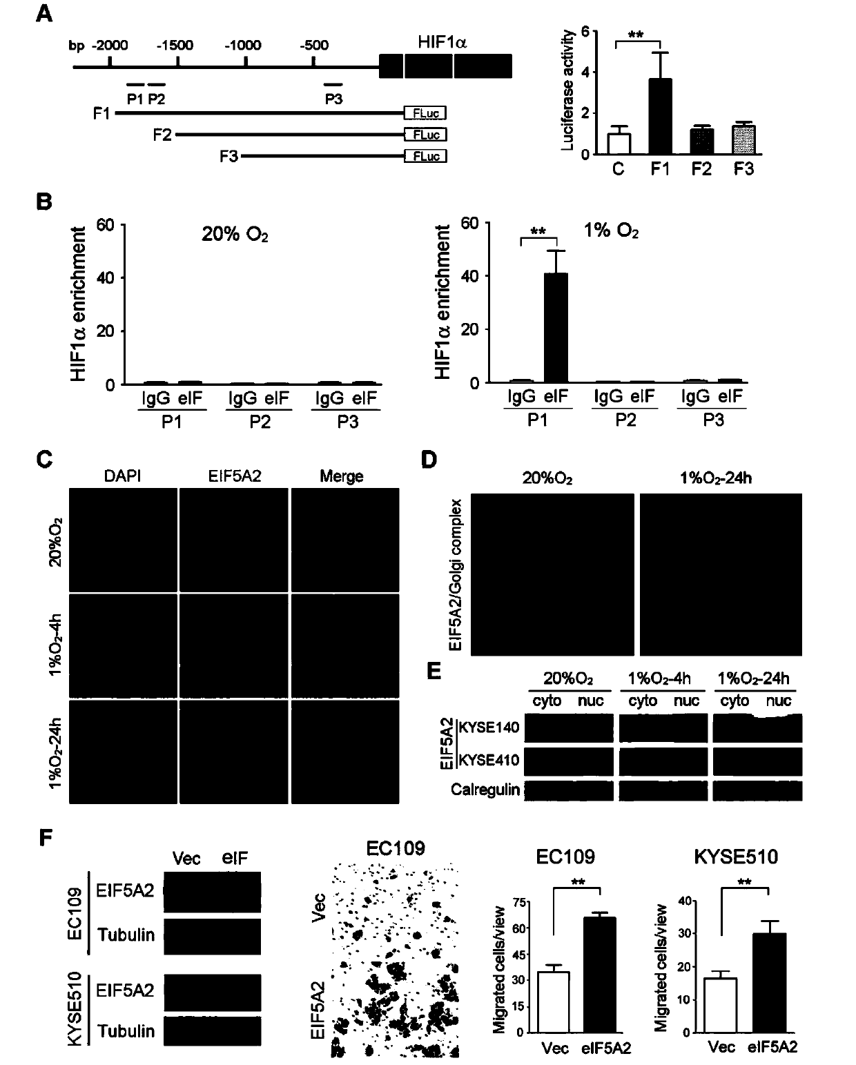 Application of EIF5A2 to preparation of esophageal squamous cell carcinoma prognosis reagent