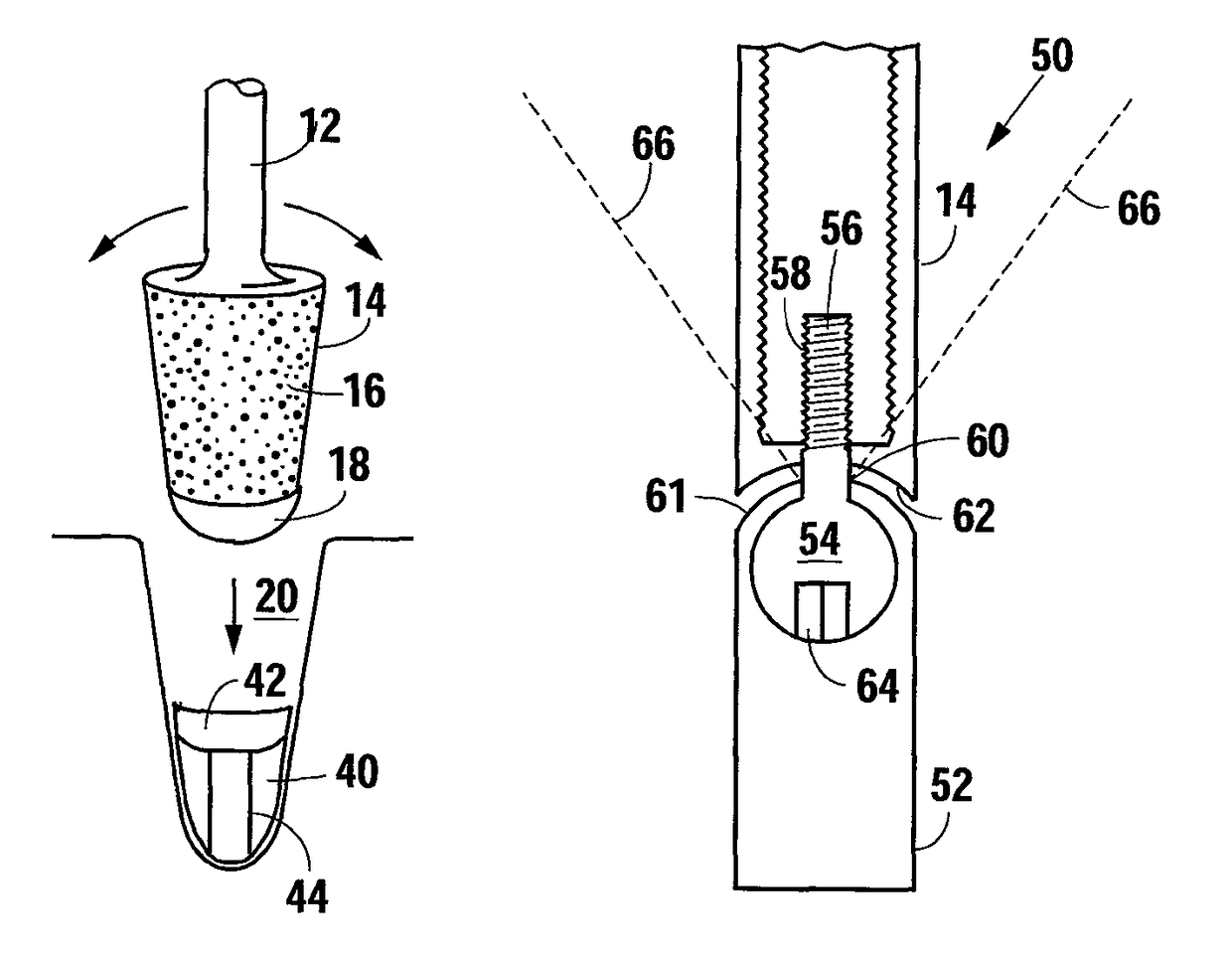 Methods and apparatus for preparing a dental implant site