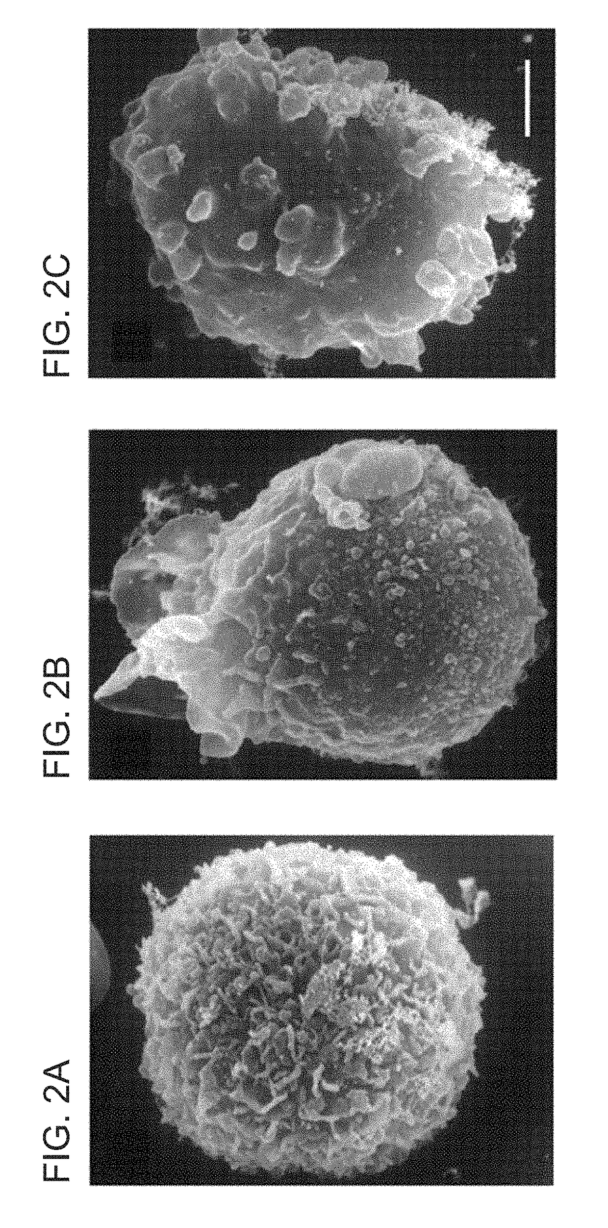 Targeting ncca-atp channel for organ protection following ischemic episode