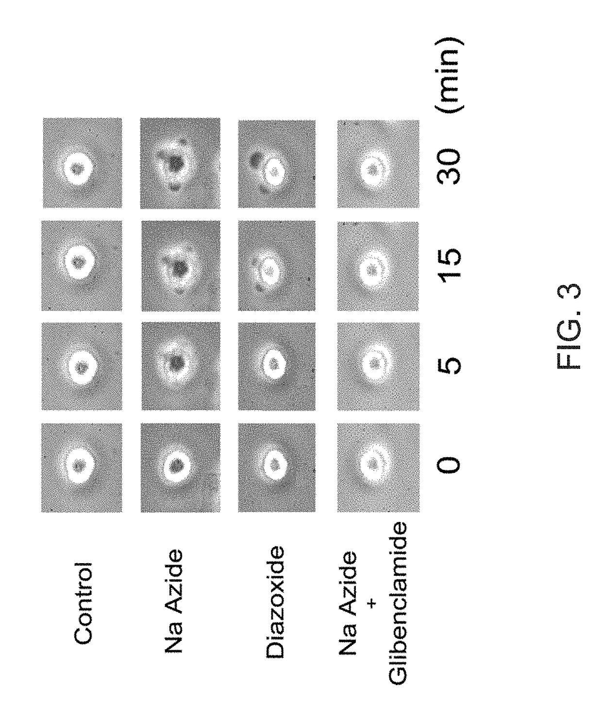 Targeting ncca-atp channel for organ protection following ischemic episode