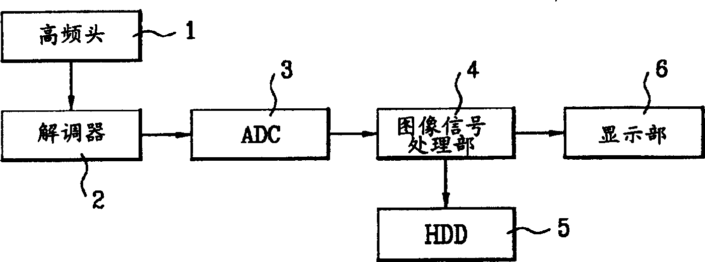 Image signal treatment device of digital television