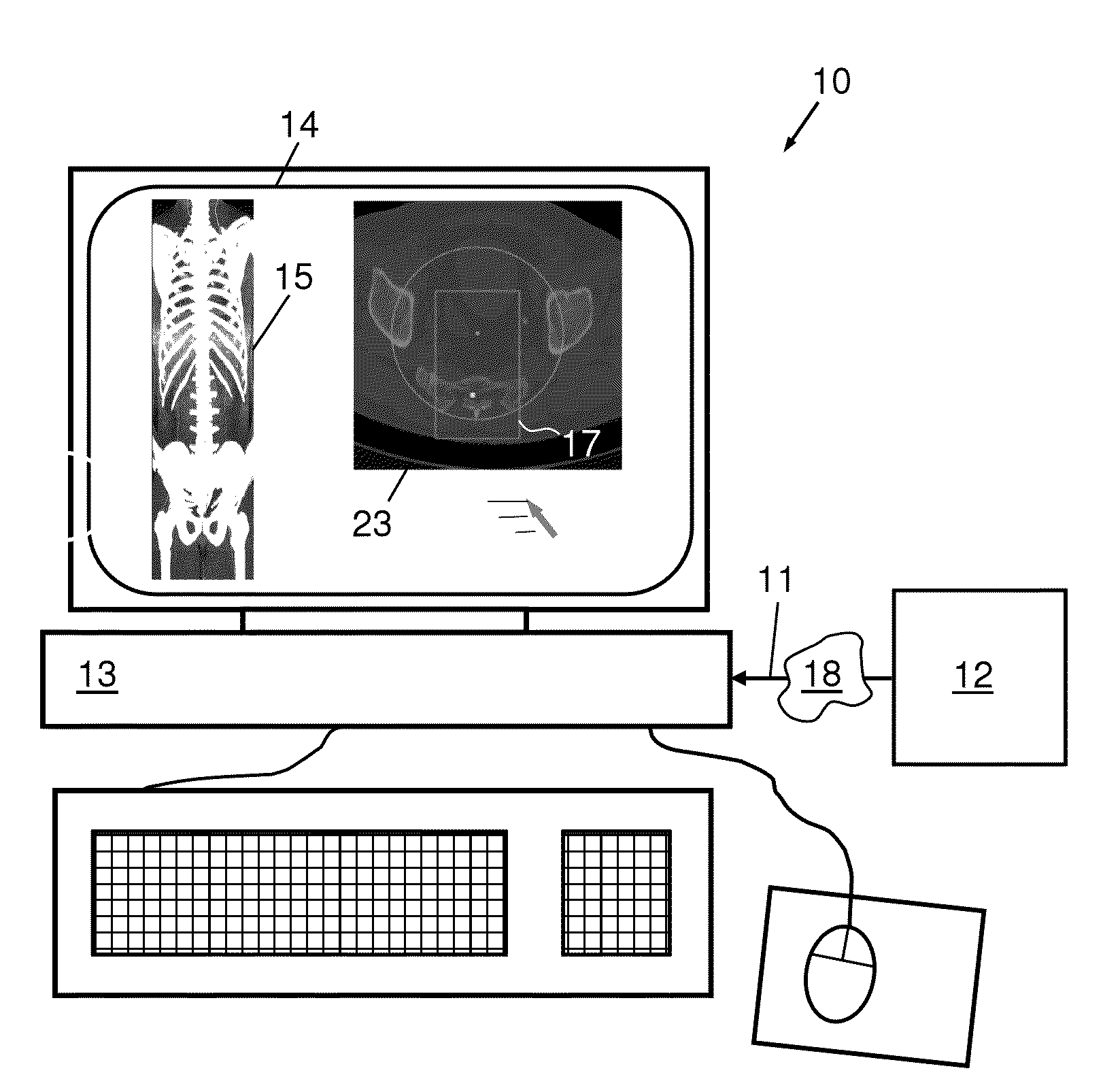 Method, apparatus and system for localizing a spine