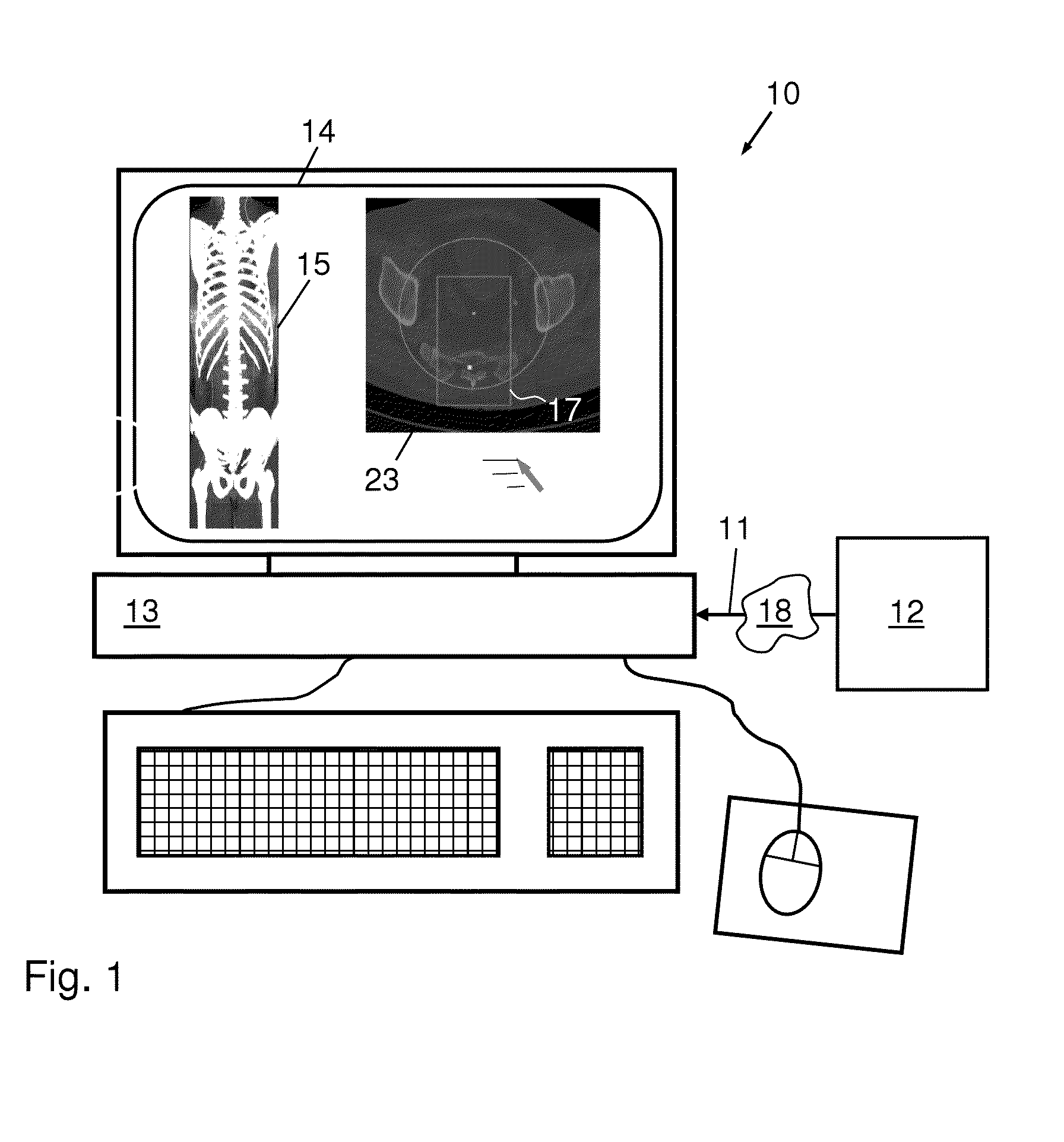 Method, apparatus and system for localizing a spine