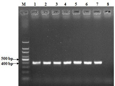 A kind of pcr amplification primer for rapid detection of ovine mycoplasma pneumoniae and its application