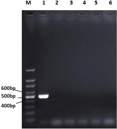 A kind of pcr amplification primer for rapid detection of ovine mycoplasma pneumoniae and its application