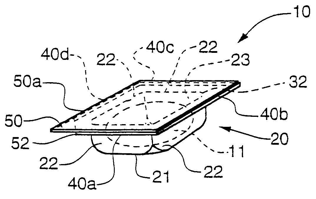 Dental composite restorative material and method of restoring a tooth