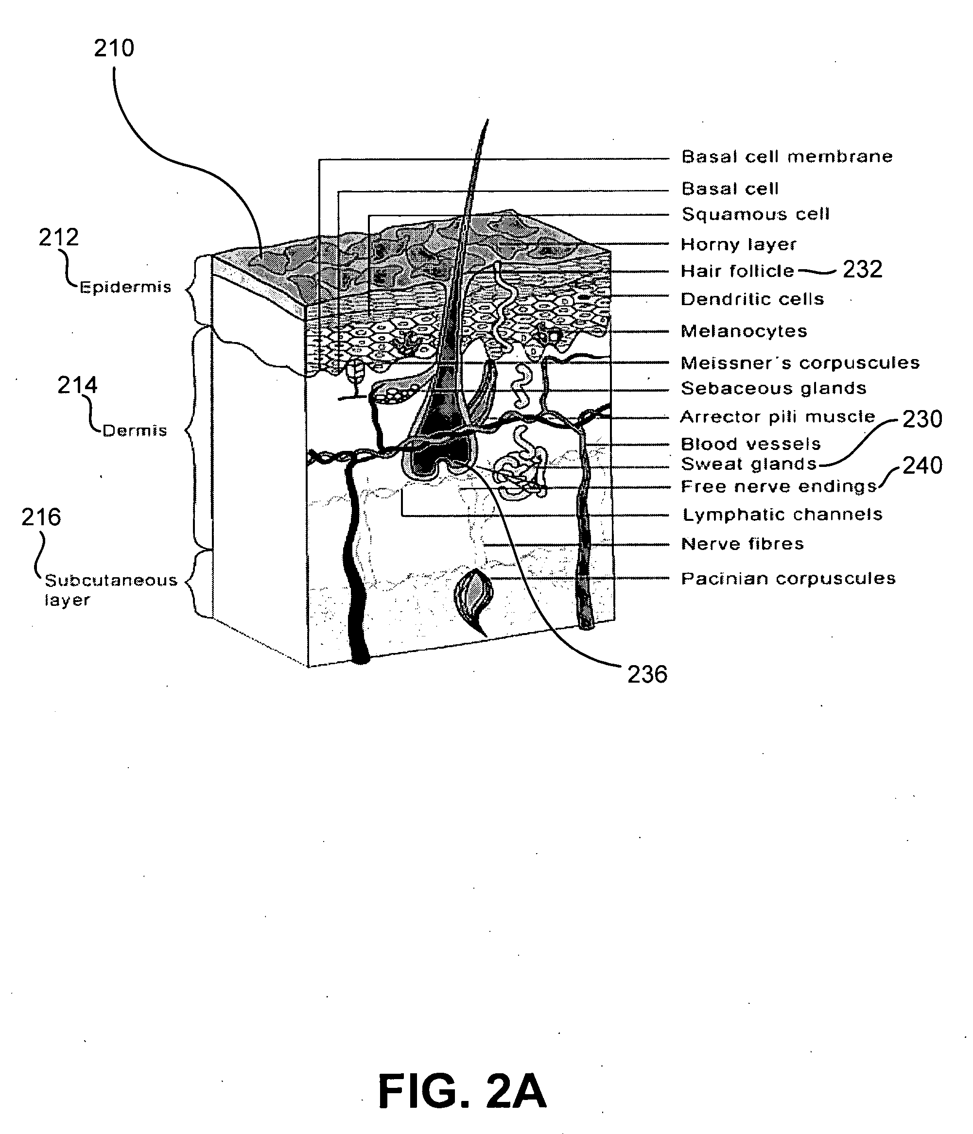 Method and system for treatment of sweat glands