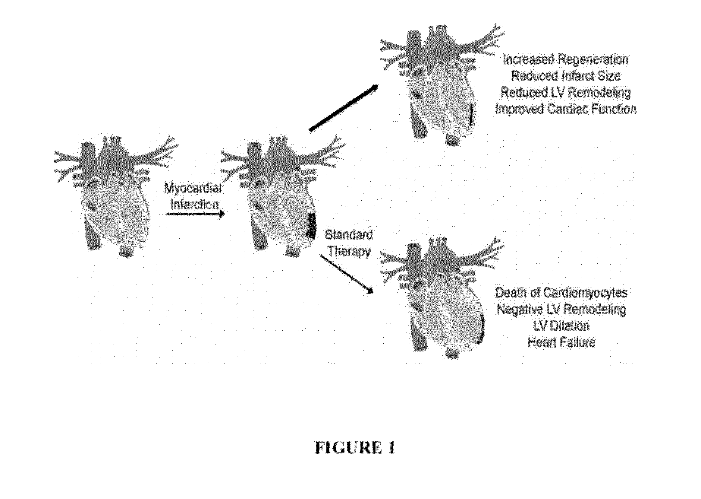 Compositions and methods for cardiac therapy