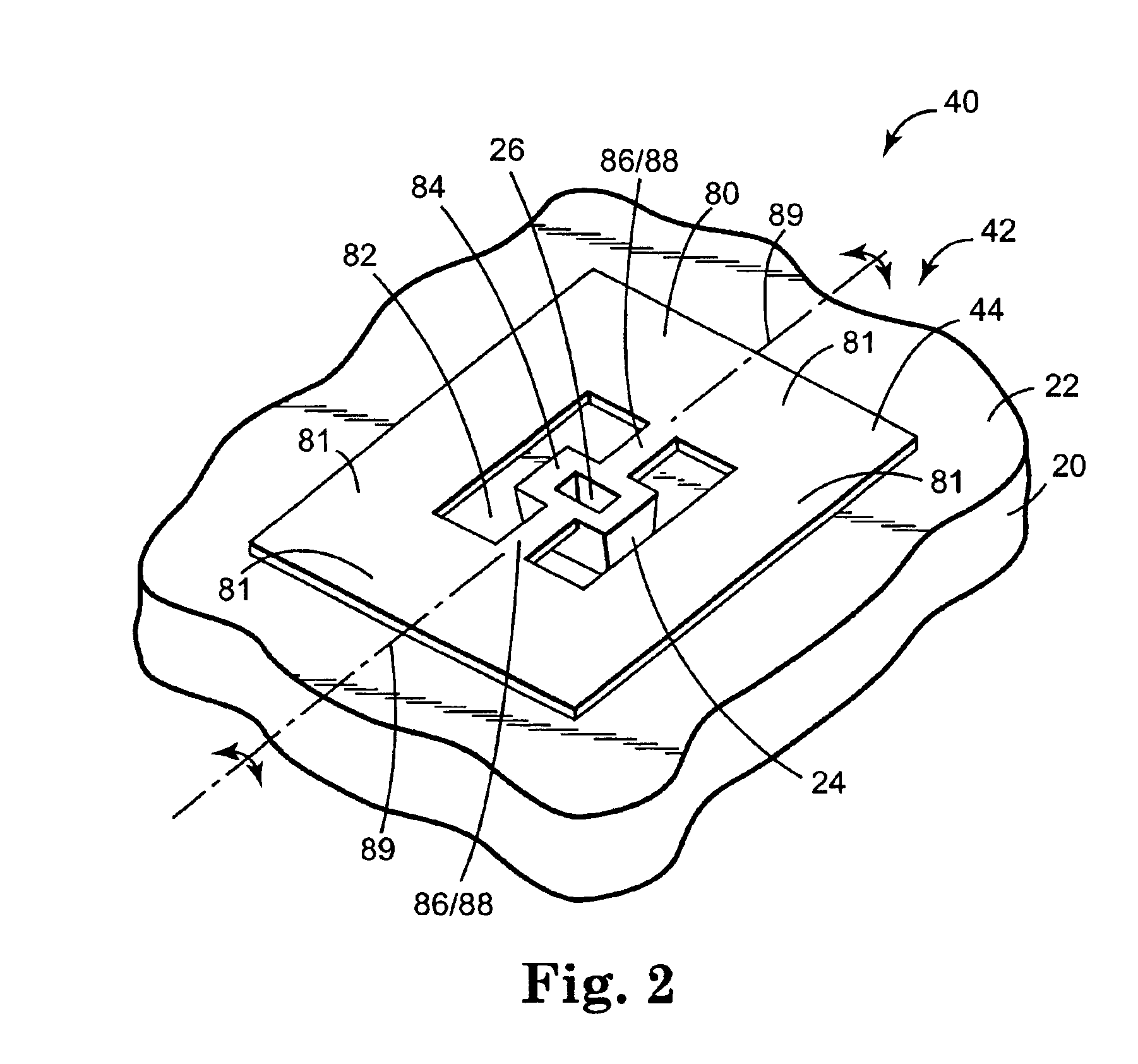 Method of forming MEMS device