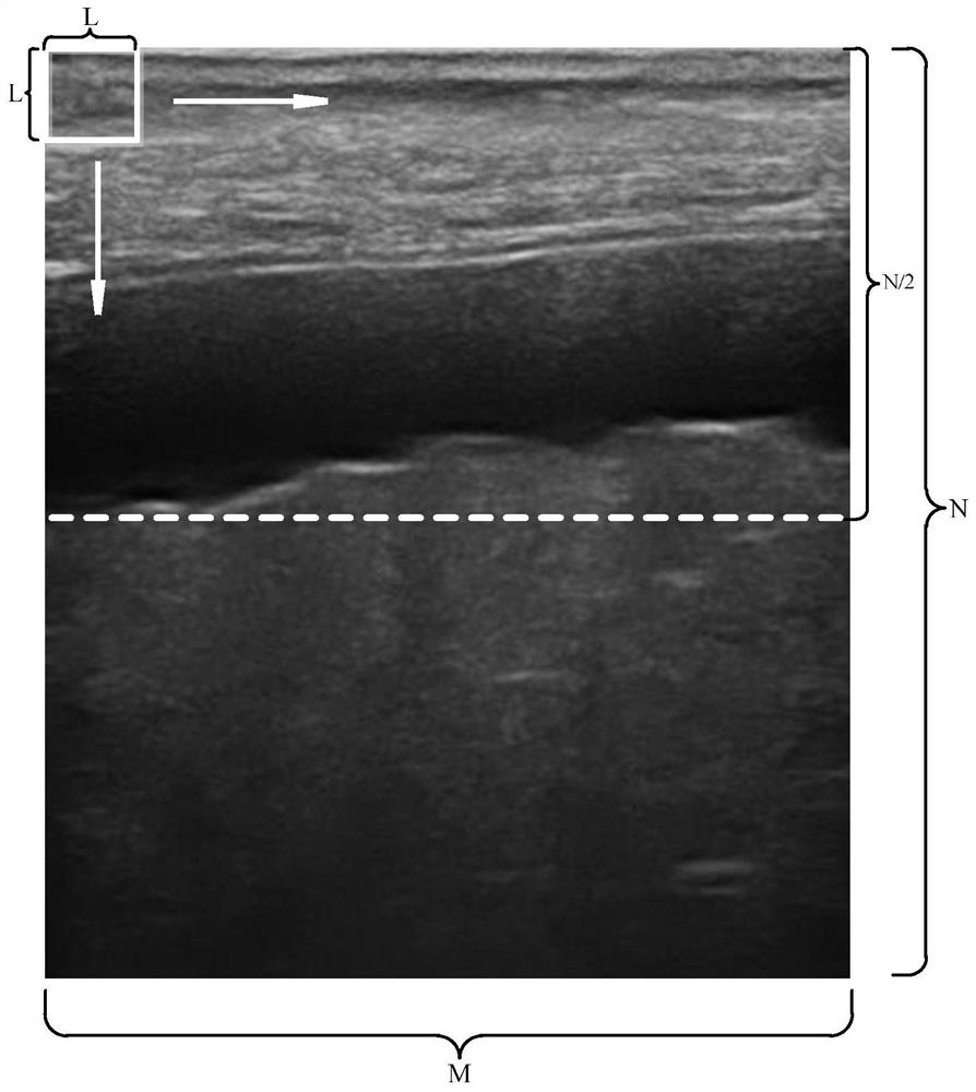 Liver cirrhosis ultrasonic image liver envelope extraction method based on digital image processing technology