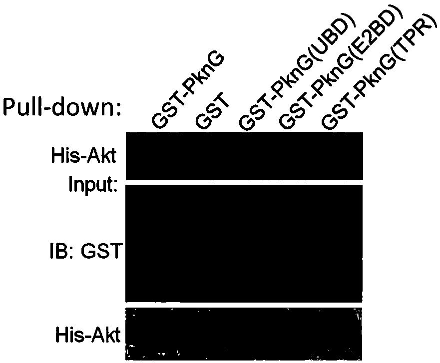 Target for resisting mycobacterium tuberculosis and applications thereof