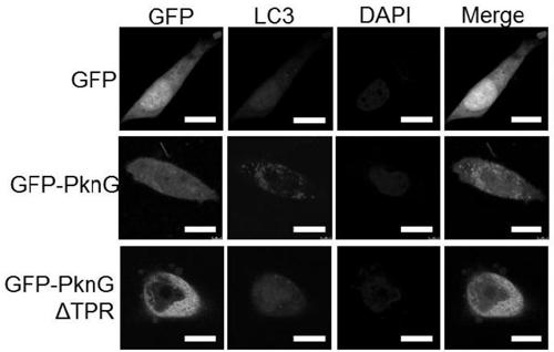 Target for resisting mycobacterium tuberculosis and applications thereof