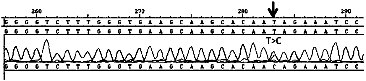 Reagent kit for detecting pathologic myopia and use method and purpose of reagent kit