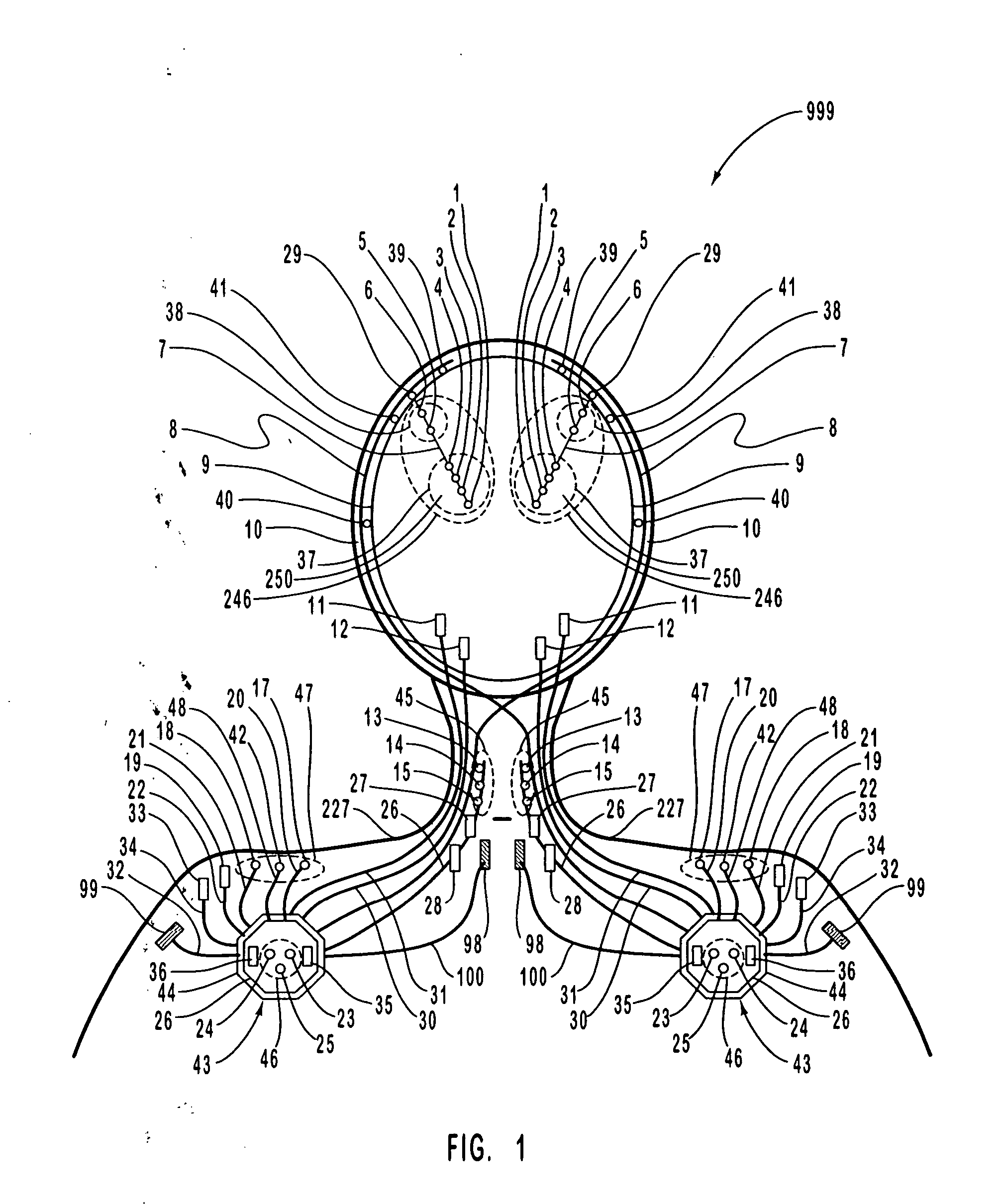 Apparatus and method for closed-loop intracranial stimulation for optimal control of neurological disease