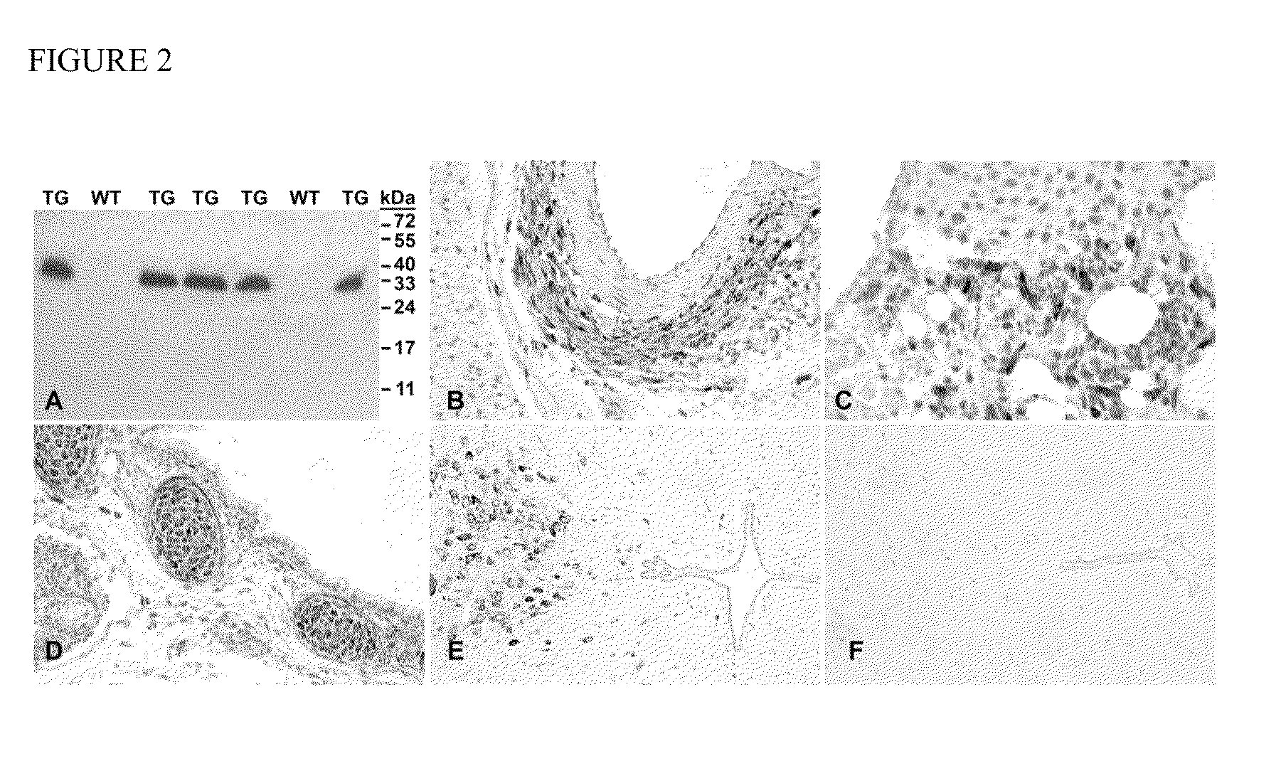 Methods for treating metabolic syndrome with Cthrc1 polypeptide