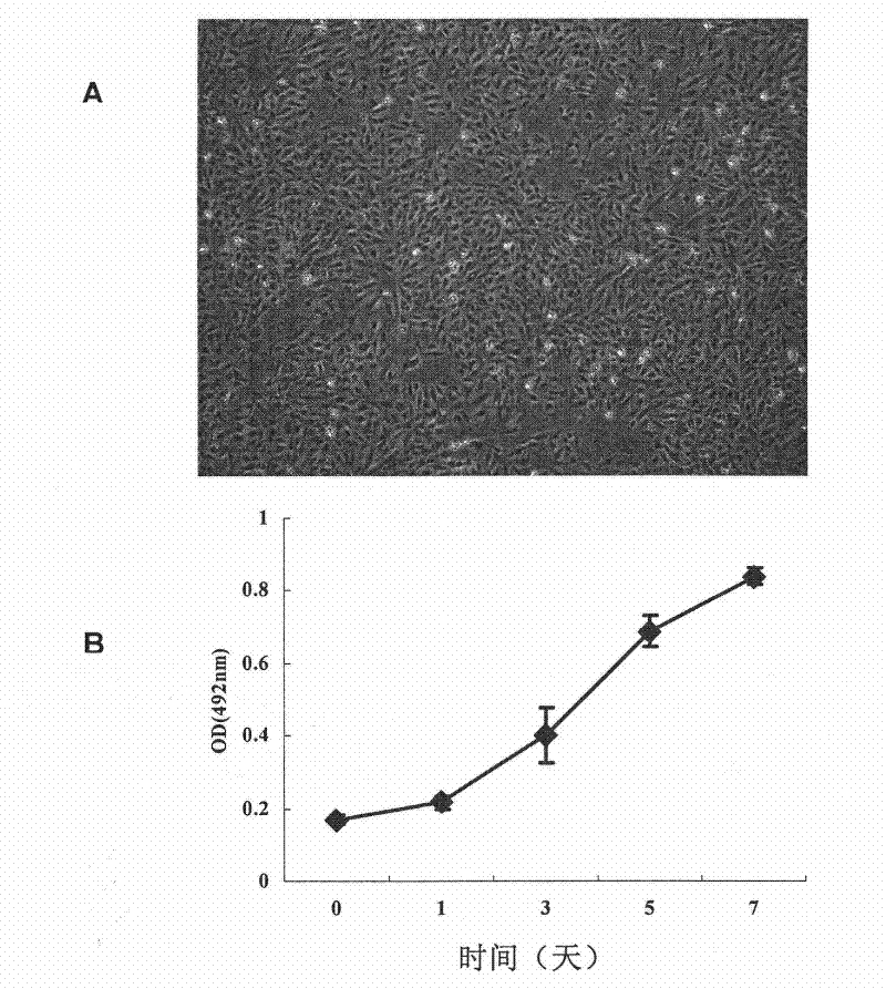 Immortalized human liver cell line, preparation method and application thereof
