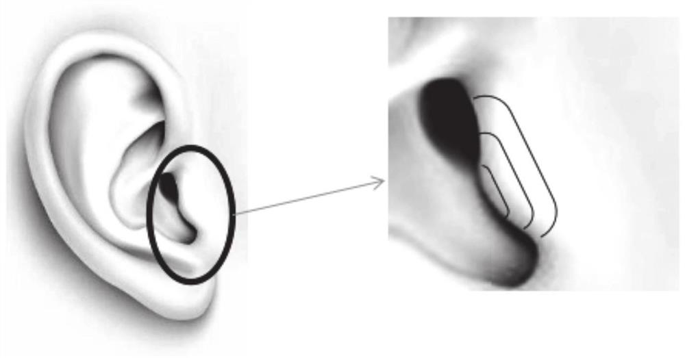 Ear skin surface area calculation method and system based on ear three-dimensional model