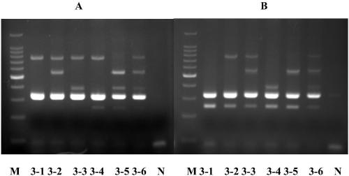 Chimeric primer multiplex PCR molecular detection kit and detection method for simultaneous detection of malaria species