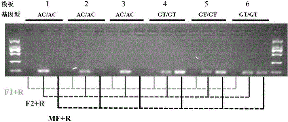 Primers for rapidly identifying bemisia tabaci sodium ion channel gene mutation T929V and application thereof