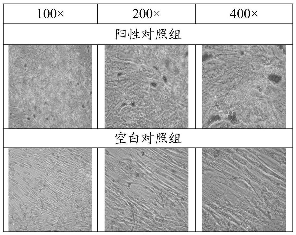 A culture medium and its application and method for inducing tendon stem cells to differentiate into fat cells