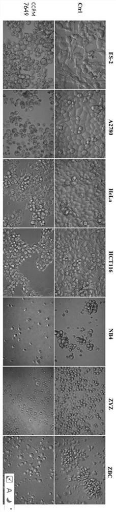 A Streptomyces ccpm7649 with potent anticancer activity and its application