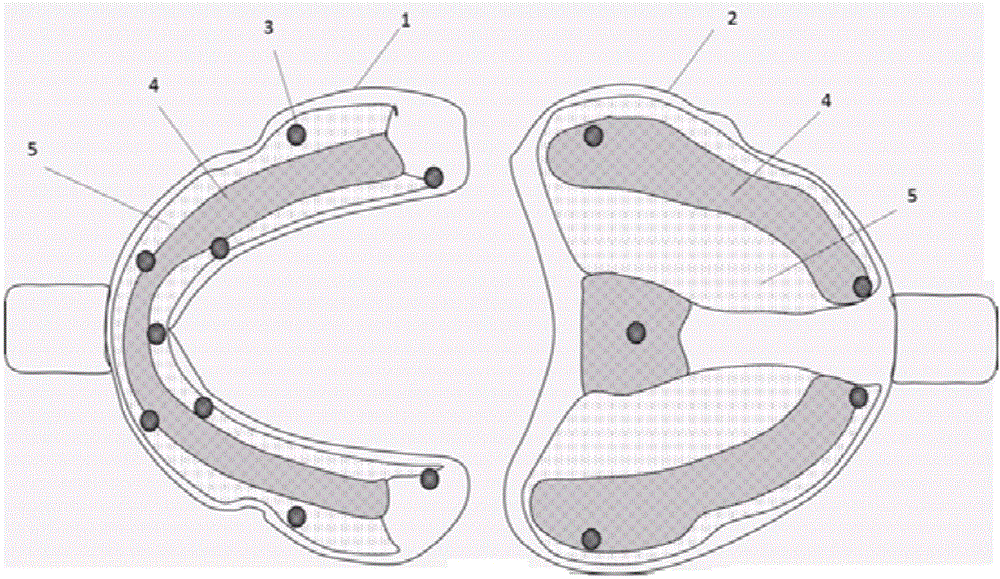 Method for improving positioning precision of edentulous personalized tray in oral cavity