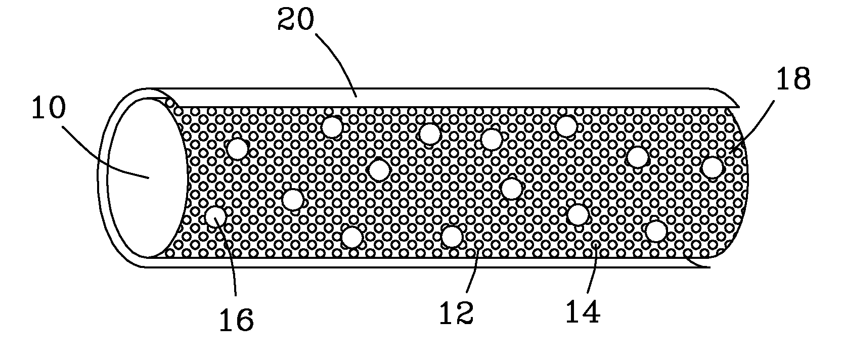 Brachytherapy Seed with Fast Dissolving Matrix for Optimal Delivery of Radionuclides to Cancer Tissue