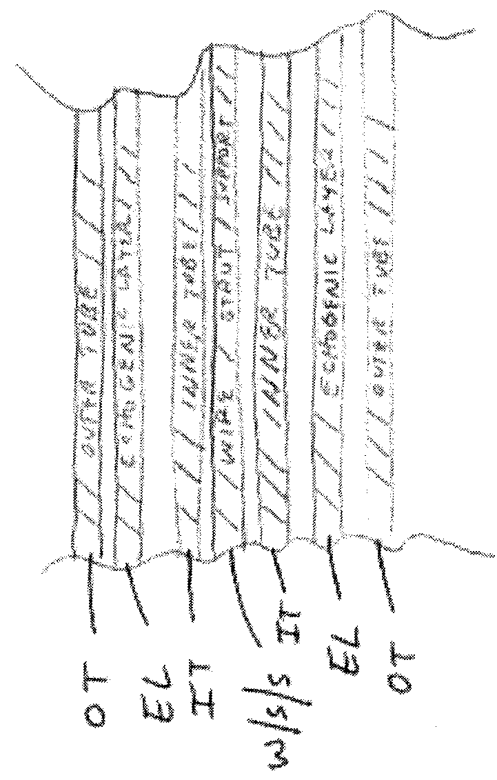 Filters with echogenic characteristics