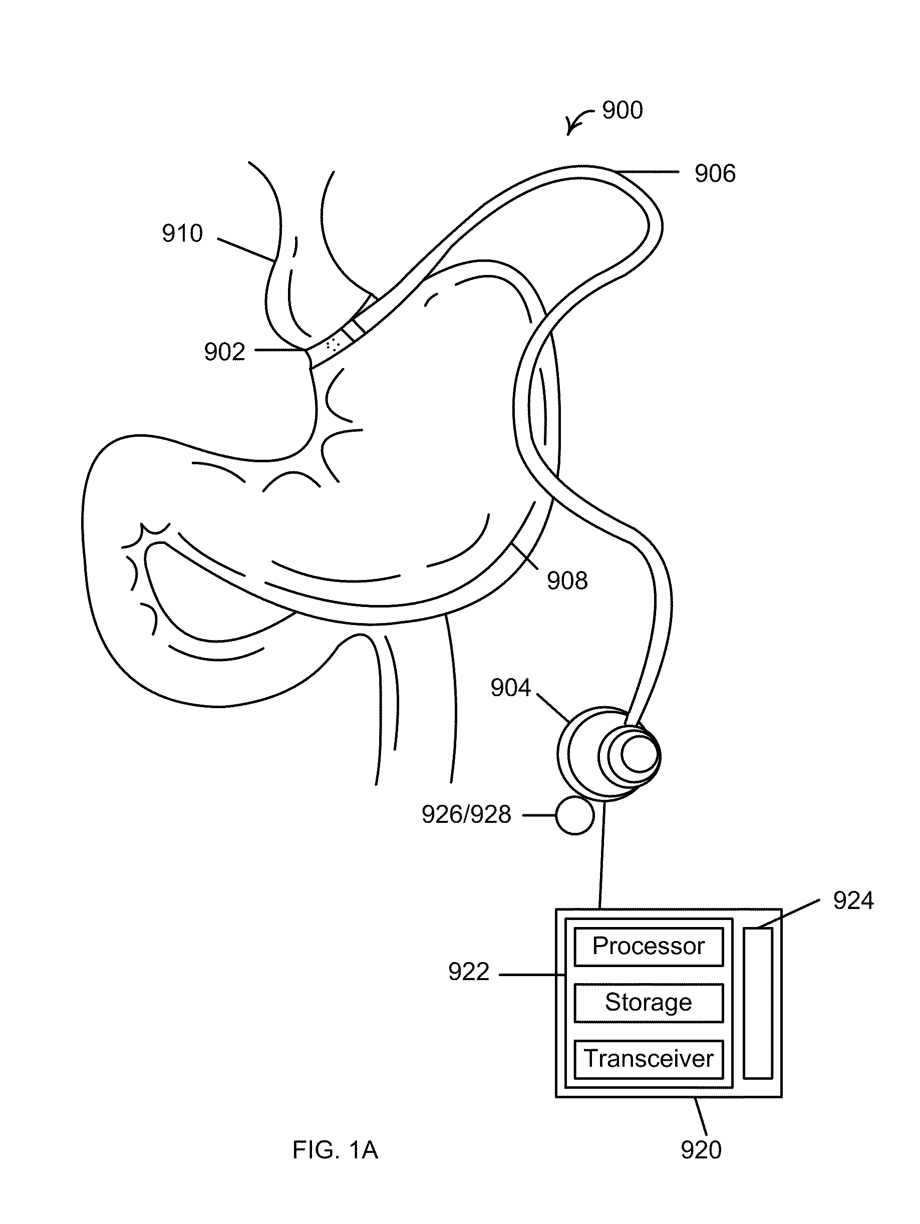 Feedback systems and methods to enhance obstructive and other obesity treatments
