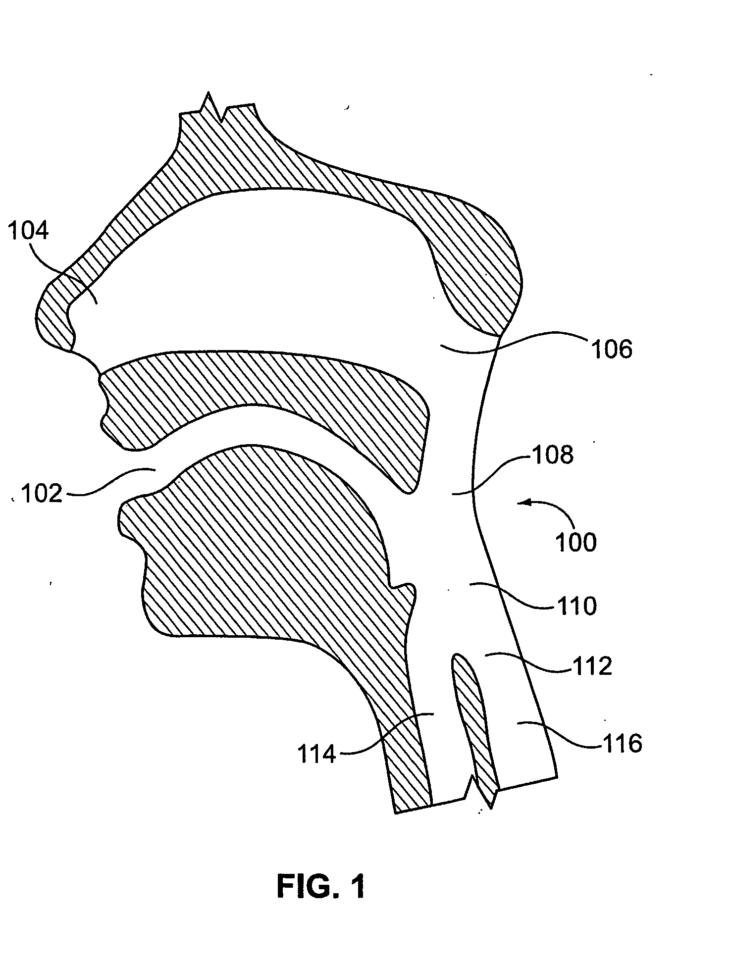System and methods of intubation
