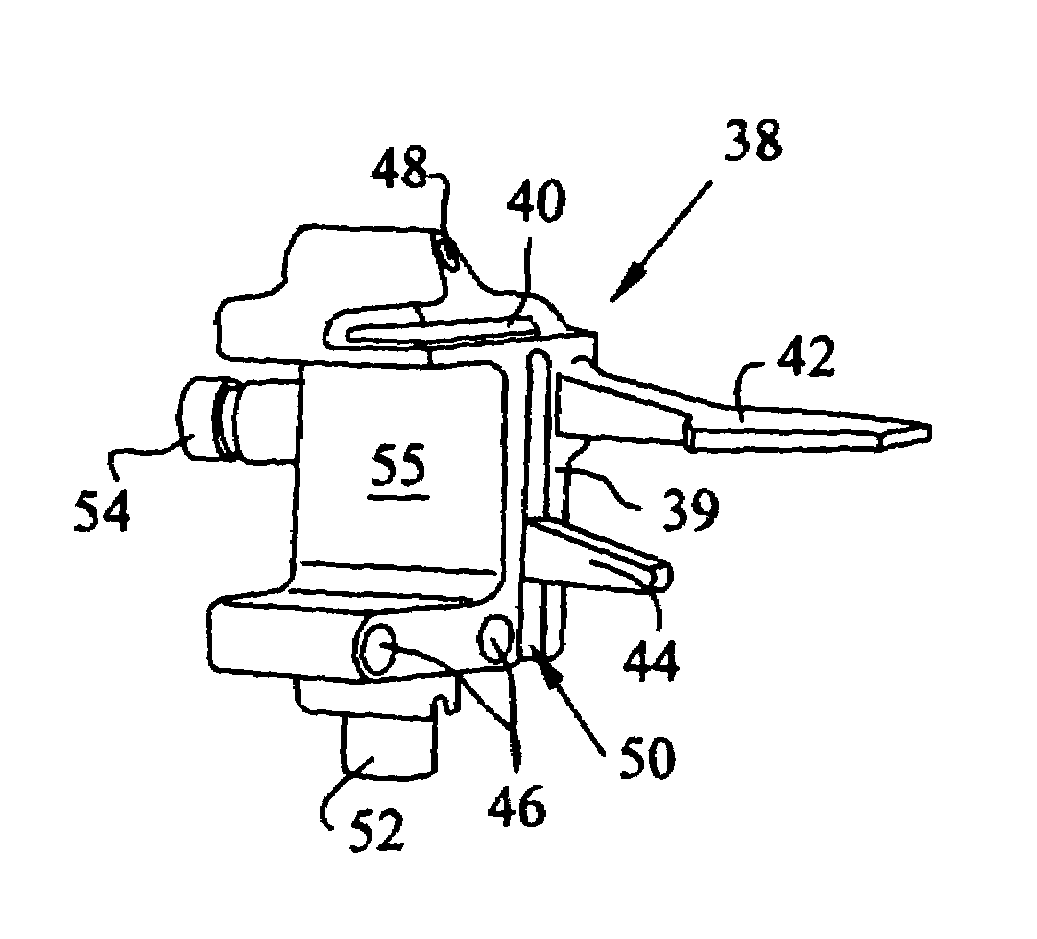 Method and apparatus for achieving correct limb alignment in unicondylar knee arthroplasty