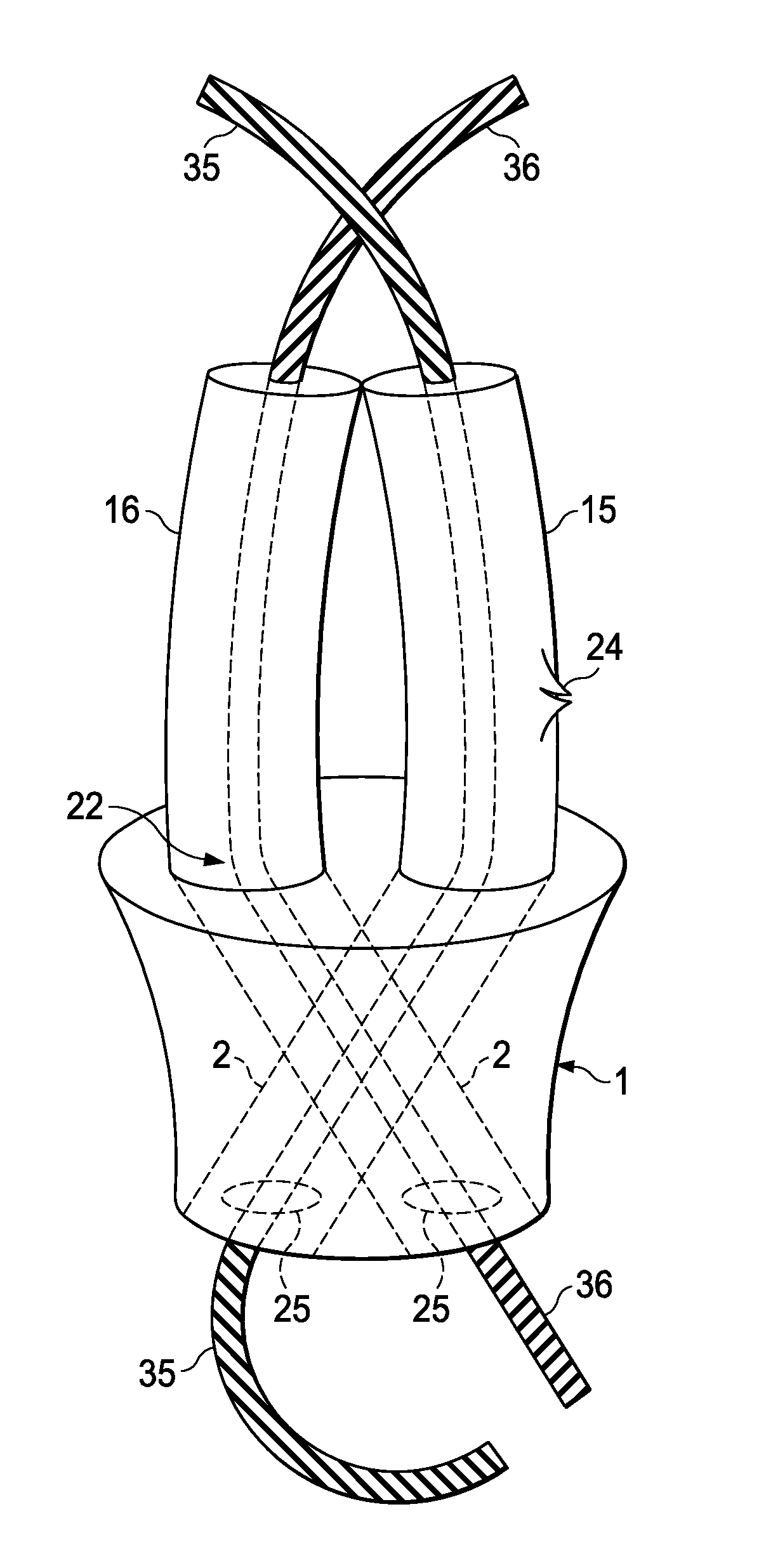 Apparatus and method for minimally invasive surgery