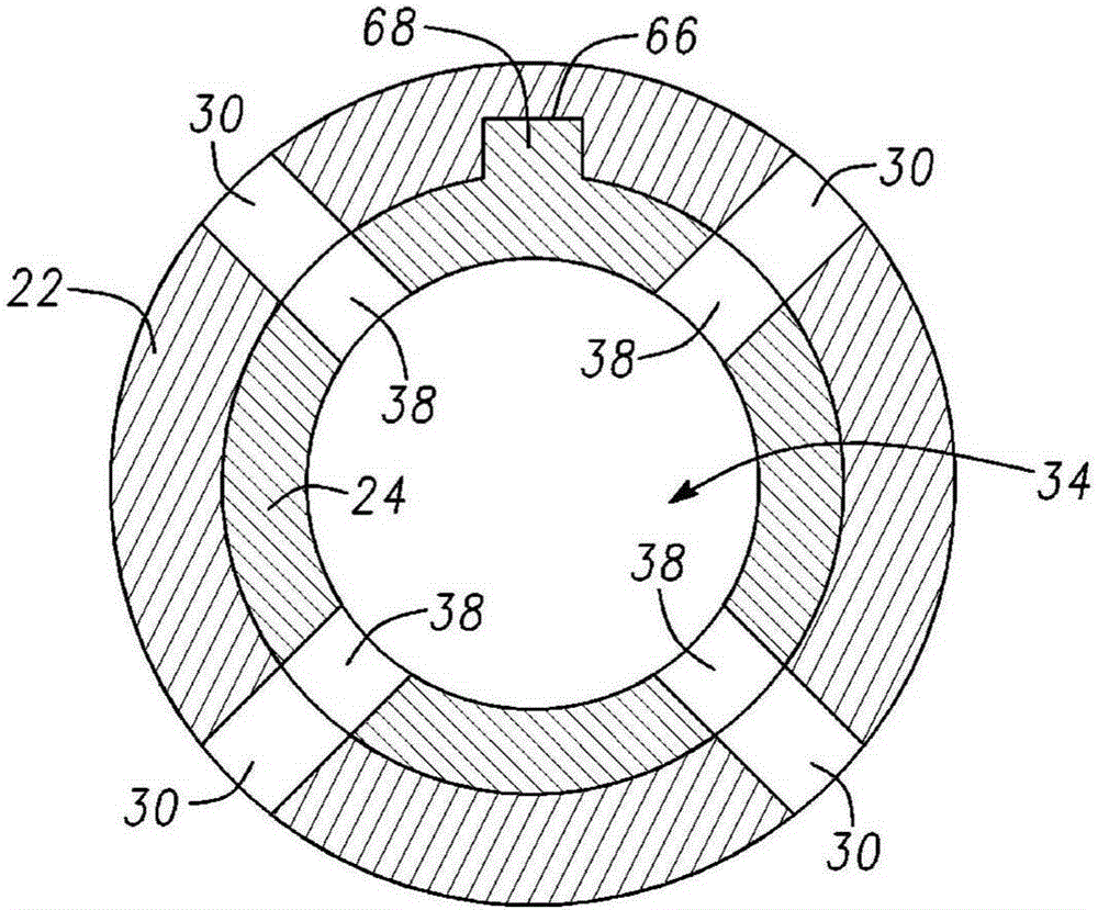 Catheter system