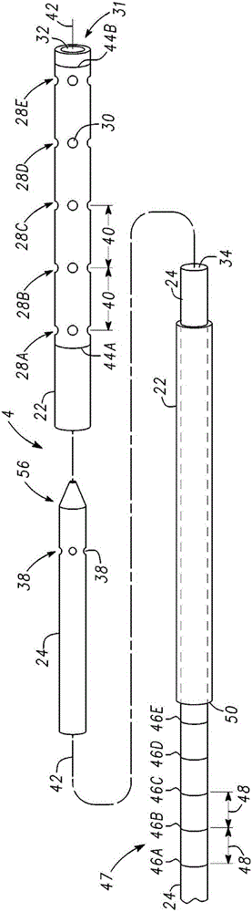 Catheter system